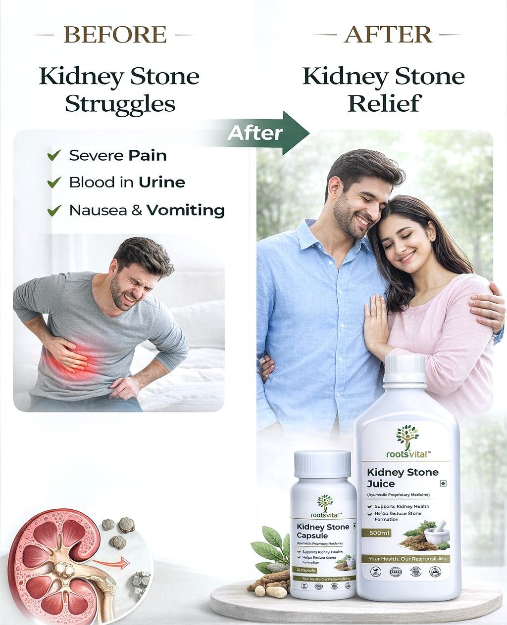 Kidney Stone Care Combo (Capsules + Juice) - Rootsvital