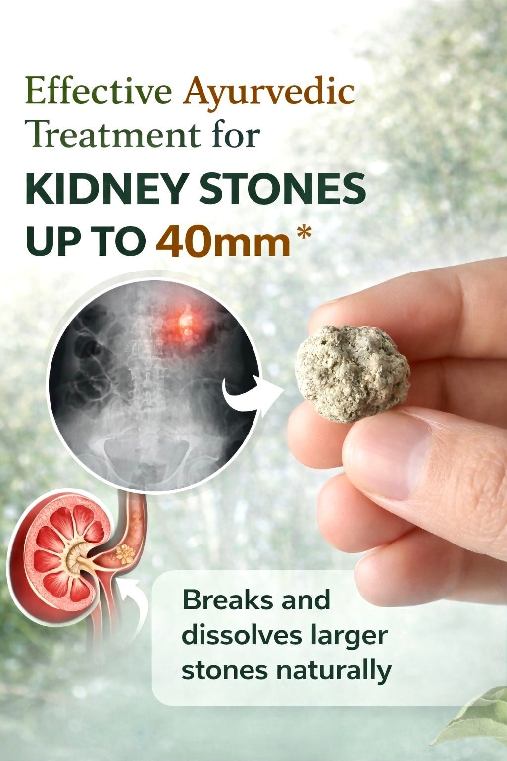Kidney Stone Care Combo (Capsules + Juice) - Rootsvital